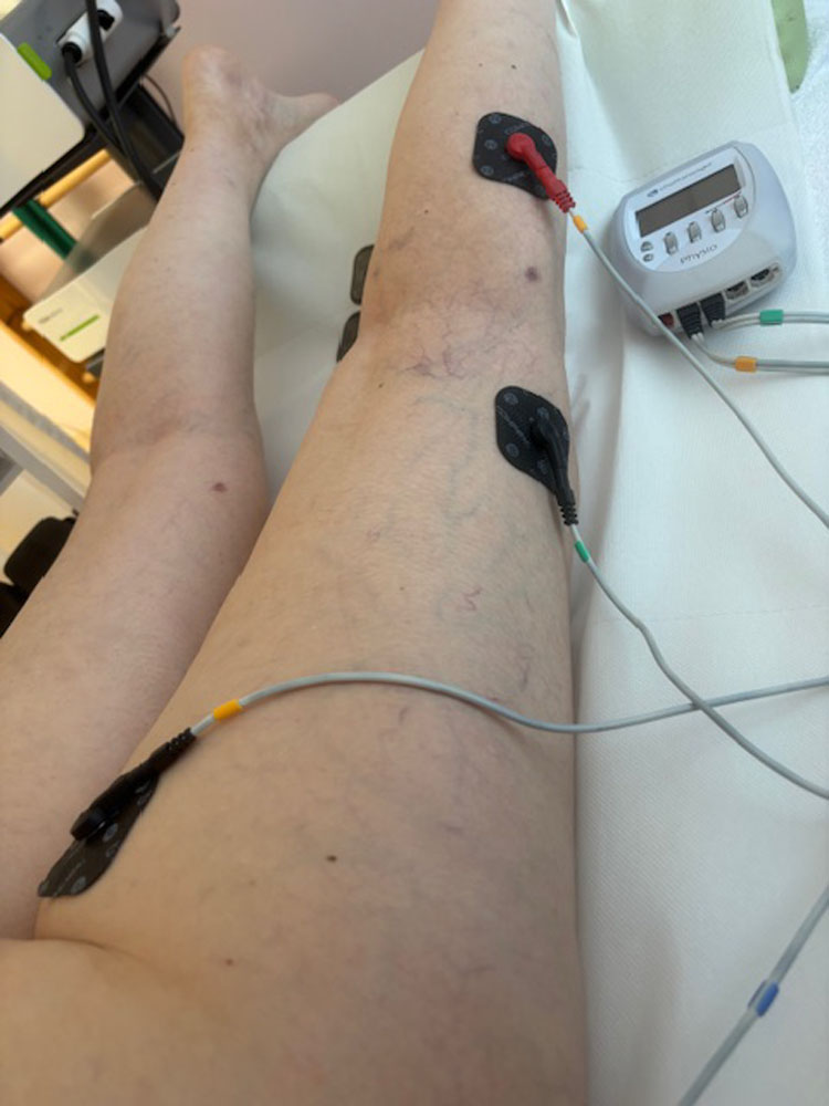 COMPEX ELEKTROTERAPIJA 001