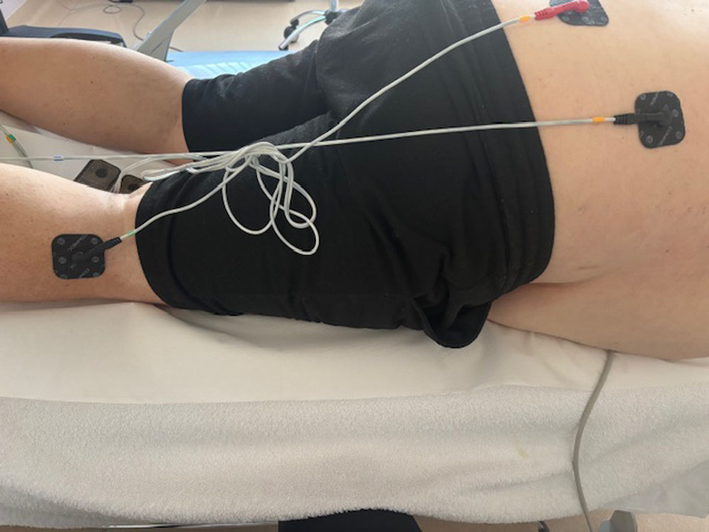 COMPEX ELEKTROTERAPIJA 003