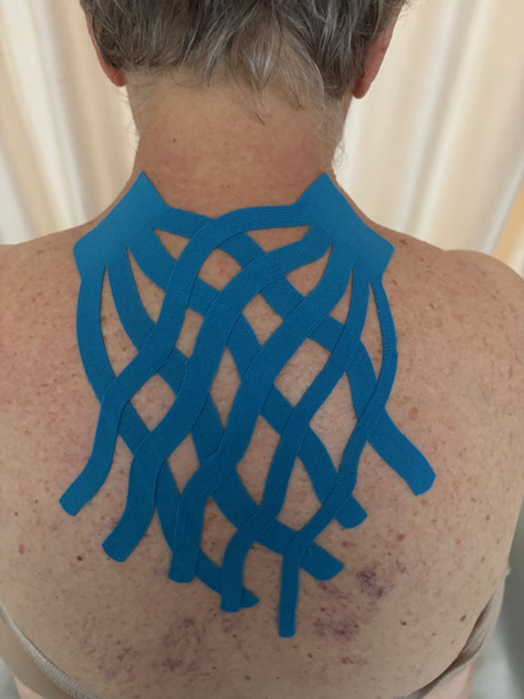 KINESIO 004